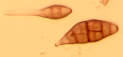 Spores d’alternaria
